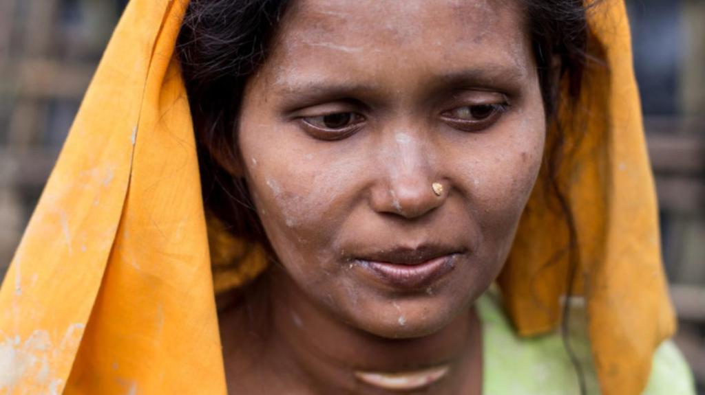 ‘Mereka Menyiksa Sampai Kami Tak Berdaya’: Pengakuan Tragis Pengungsi Rohingya