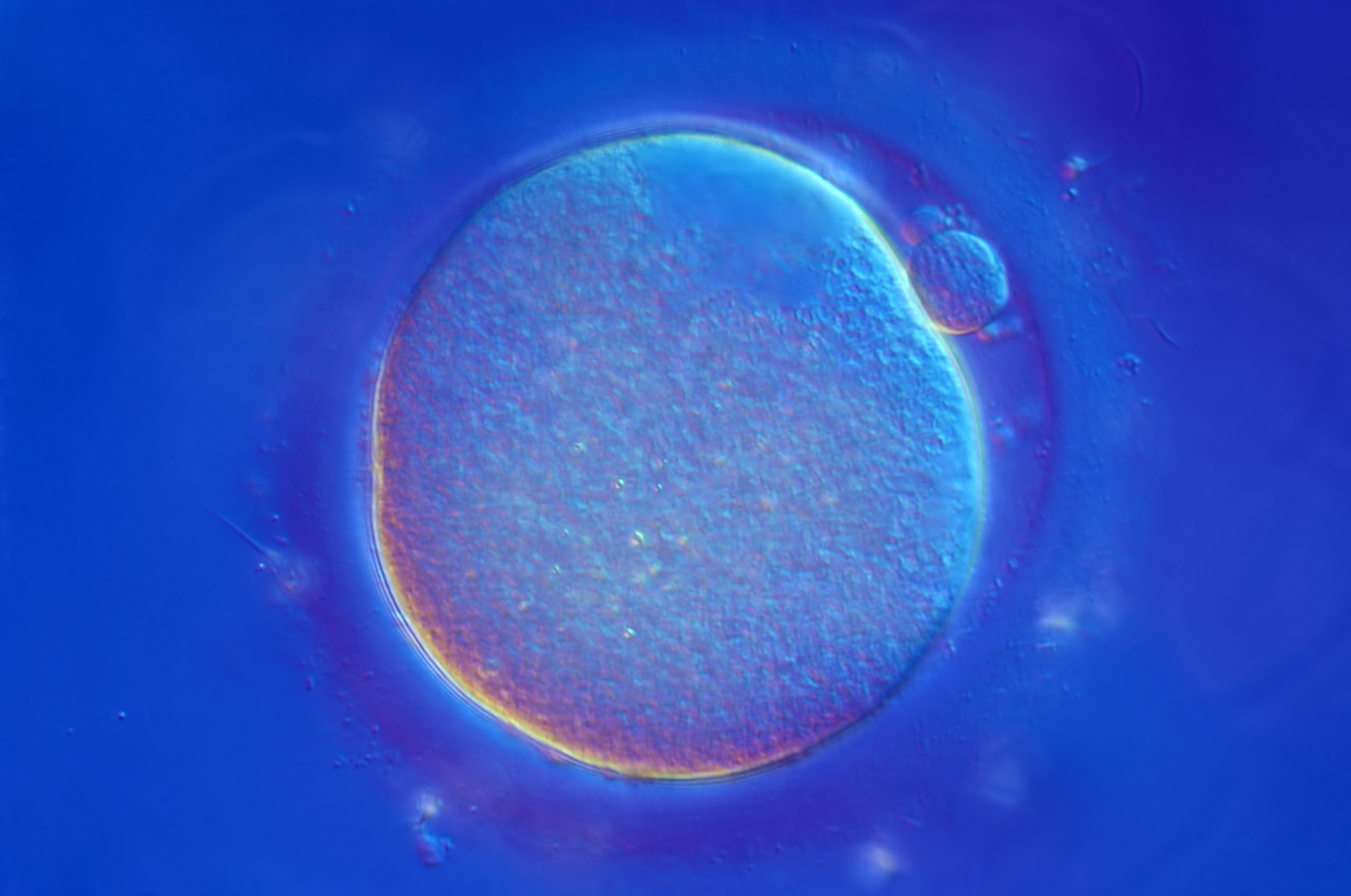 light micrograph of human oocyte from failed IVF attempt
