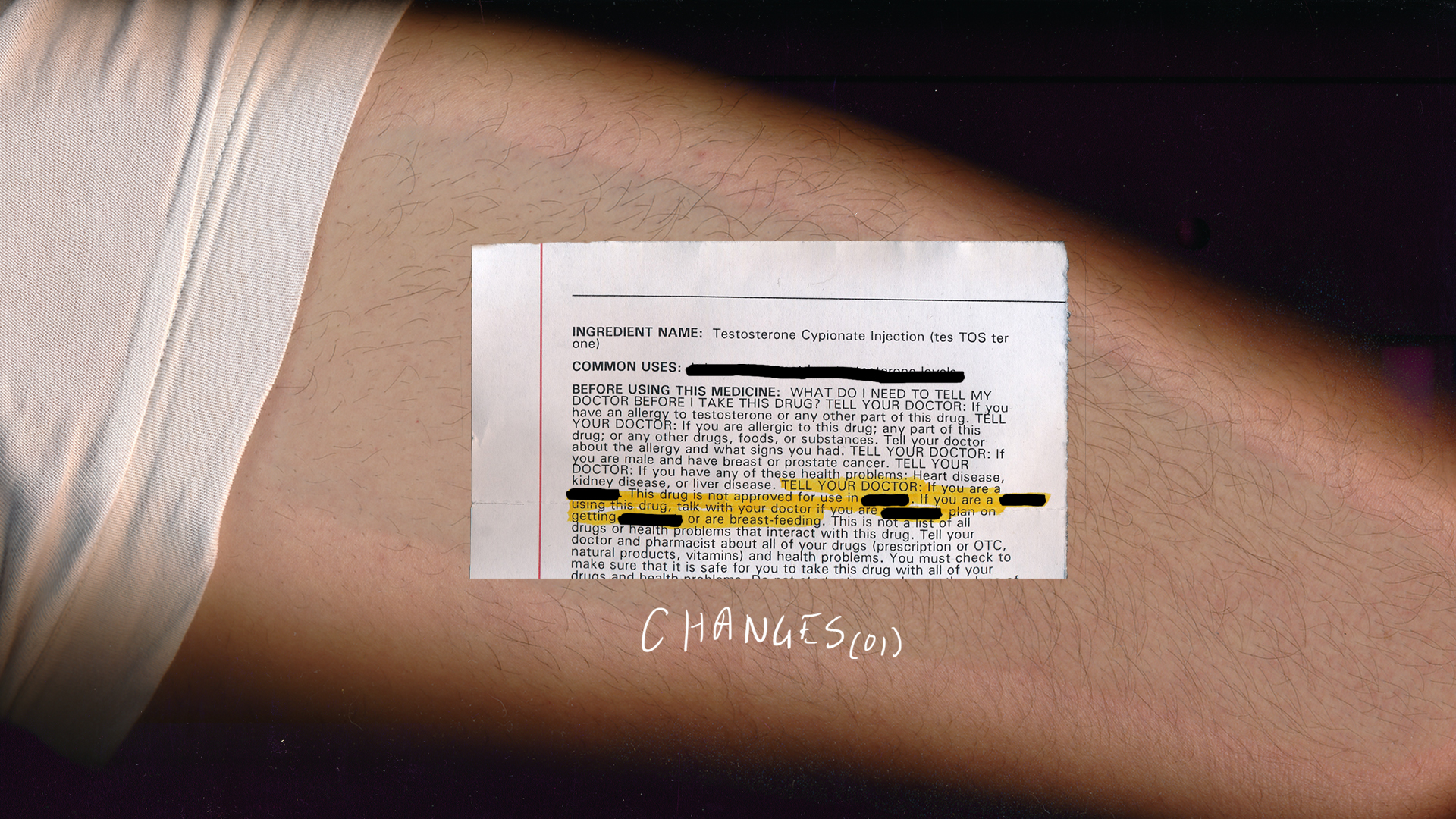 Testosterone prescription and body hair