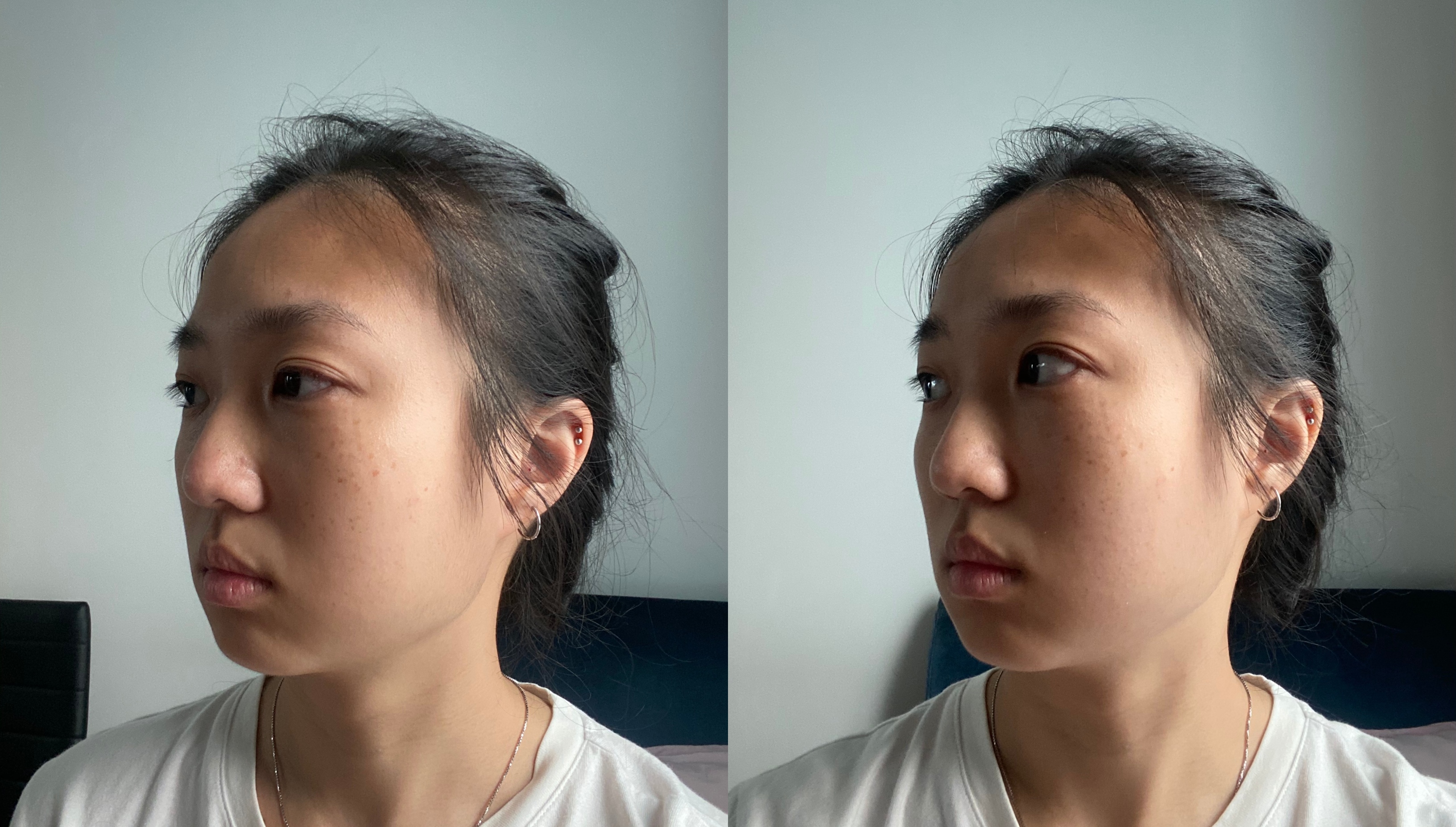 gua sha rezultate