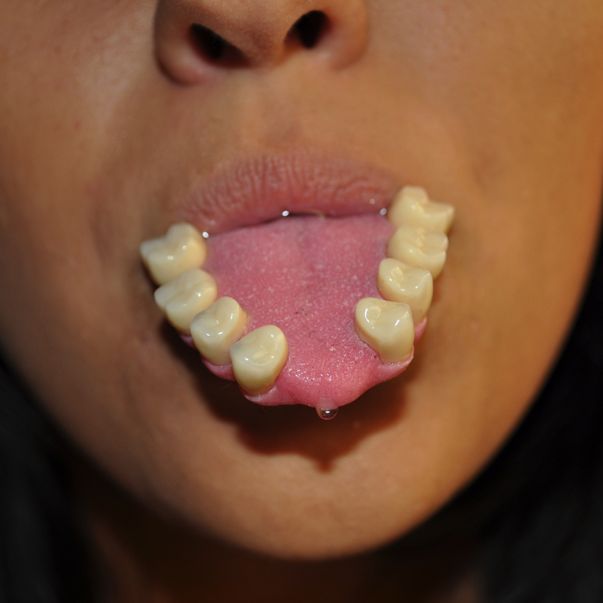 Fotografia di una figura umana che mostra una lingua coperta di denti.